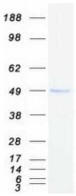 Coomassie blue staining of purified IL3RA protein.